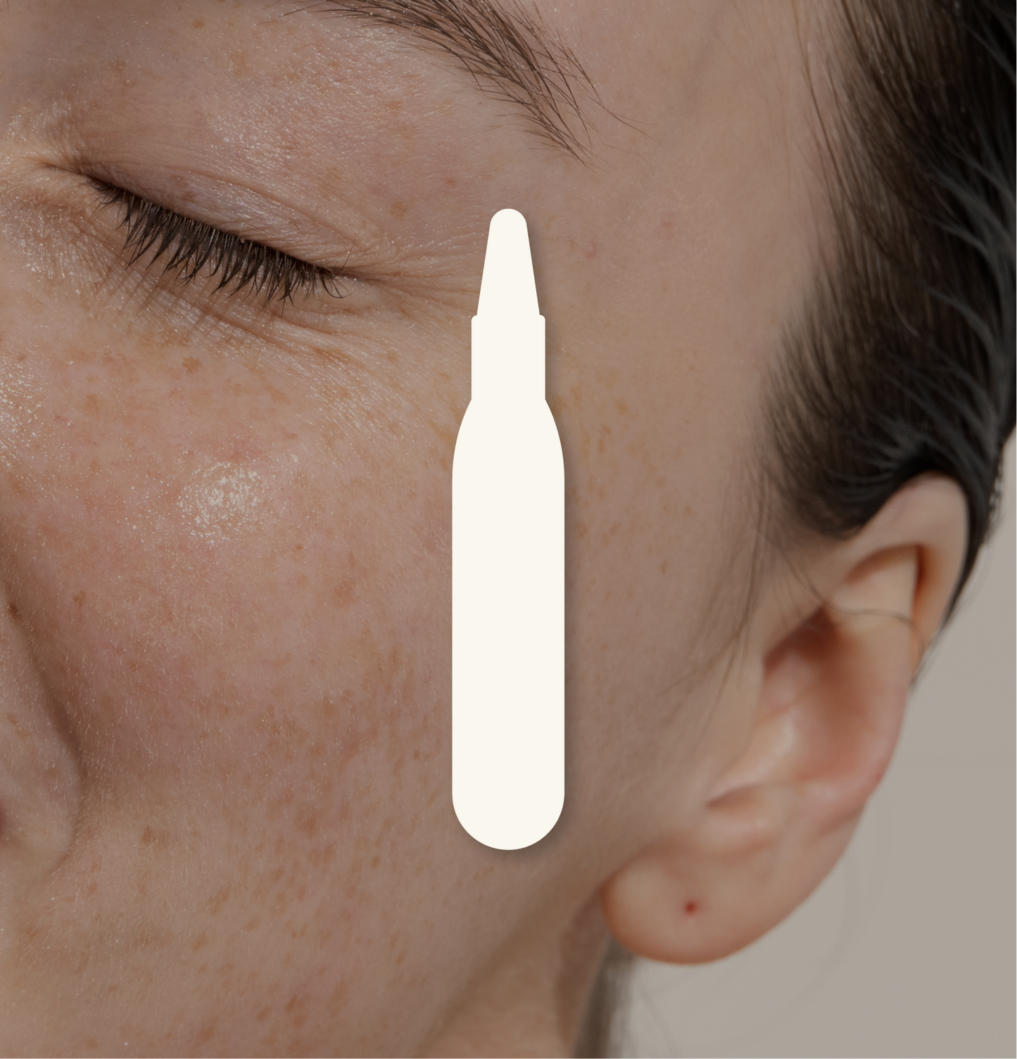 Microneedling Médico